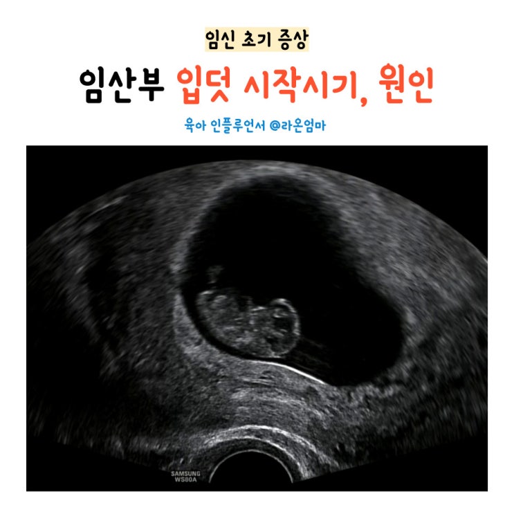임신 초기 임산부 입덧 원인 이유 시작 끝나는 시기 : 네이버 블로그