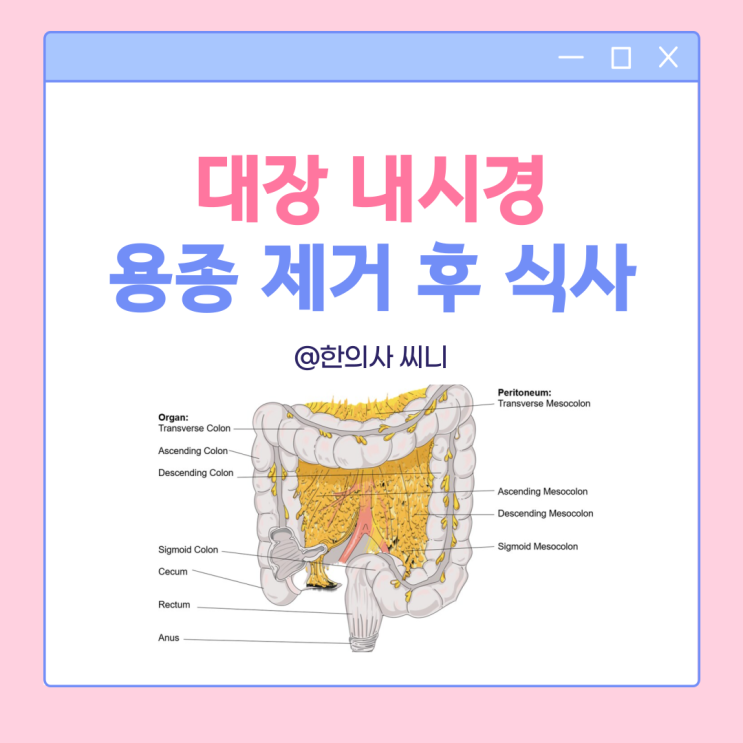 대장내시경 용종제거 후 식사 음식 커피 술 탄산음료 : 네이버 블로그