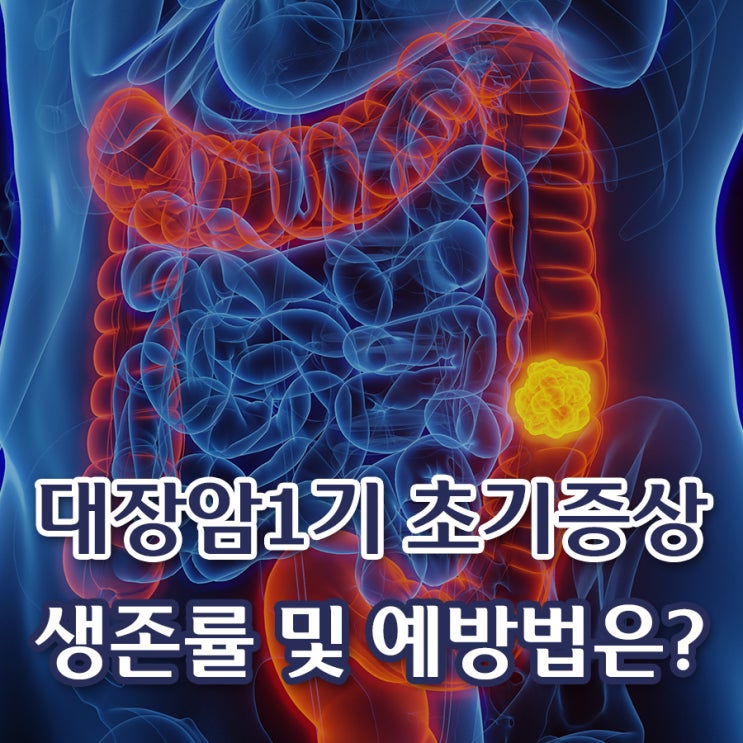 대장암초기증상 말기증상 1기 초기대장암증상 원인 생존율 예방법은? : 네이버 블로그