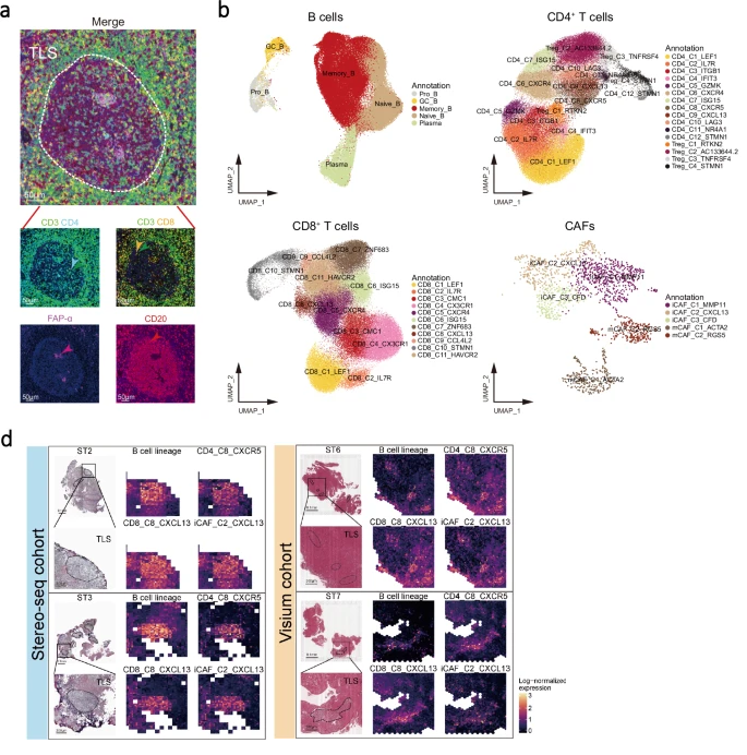 [논문소개] 단일세포(single cell) 및 공간전사체(spatial transcriptome) 분석으로 본 비인두암의 종양 ...