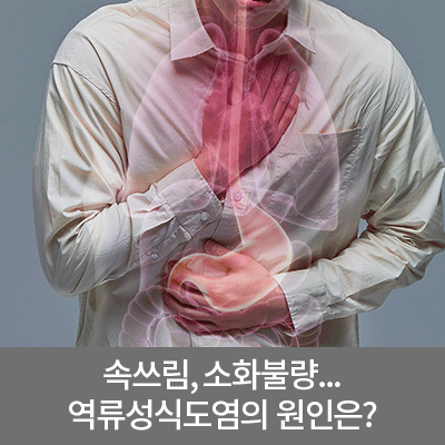 역류성 식도염, 비만이 원인이 될 수 있다? - 소화기내과 최용훈 교수