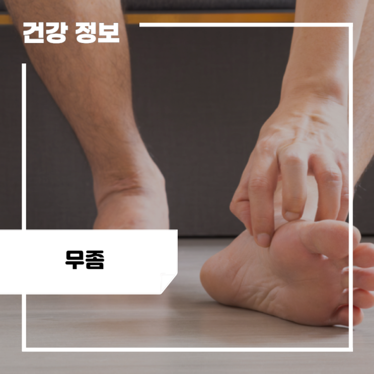 발톱 무좀 초기증상 및 원인, 검사, 무좀약 치료약: 엄지 발톱 무좀 증상 : 네이버 블로그