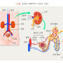 신장결석이란?