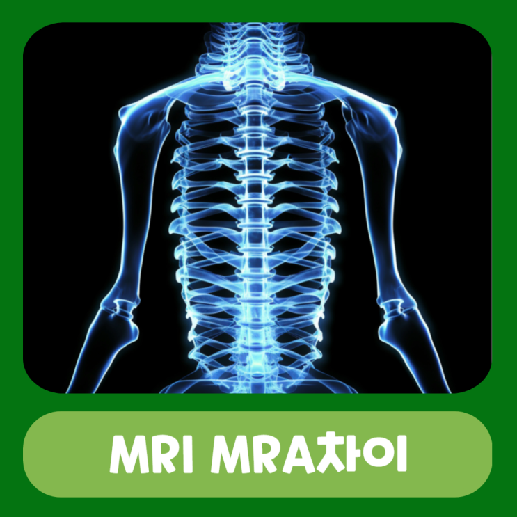 MRI MRA 차이 CT 촬영 결과 시간 비용 : 네이버 블로그