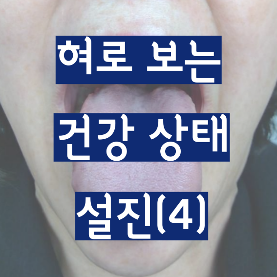 혀로 보는 건강 상태 설진 4편 - 혀가 붓고 이빨 자국이 보여요 : 네이버 블로그