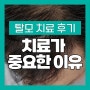 방치하면 급속도로 빨라지는 탈모 해결 방법은?