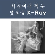 교정치과에서 찍는 옆모습 x-ray(cephalometric lateral view)는 무엇을 보는 것일까요?