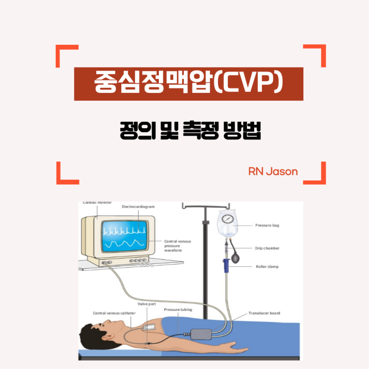 중심정맥압(CVP) 정의, 정상범위, 측정방법 및 측정이유에 대해서 알아봐요~ : 네이버 블로그