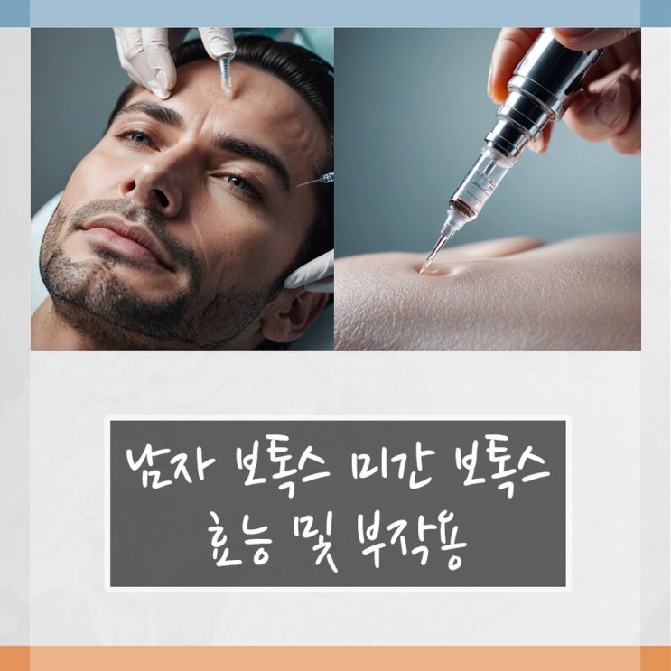 남자 보톡스 미간 보톡스 효능 및 부작용 : 네이버 블로그