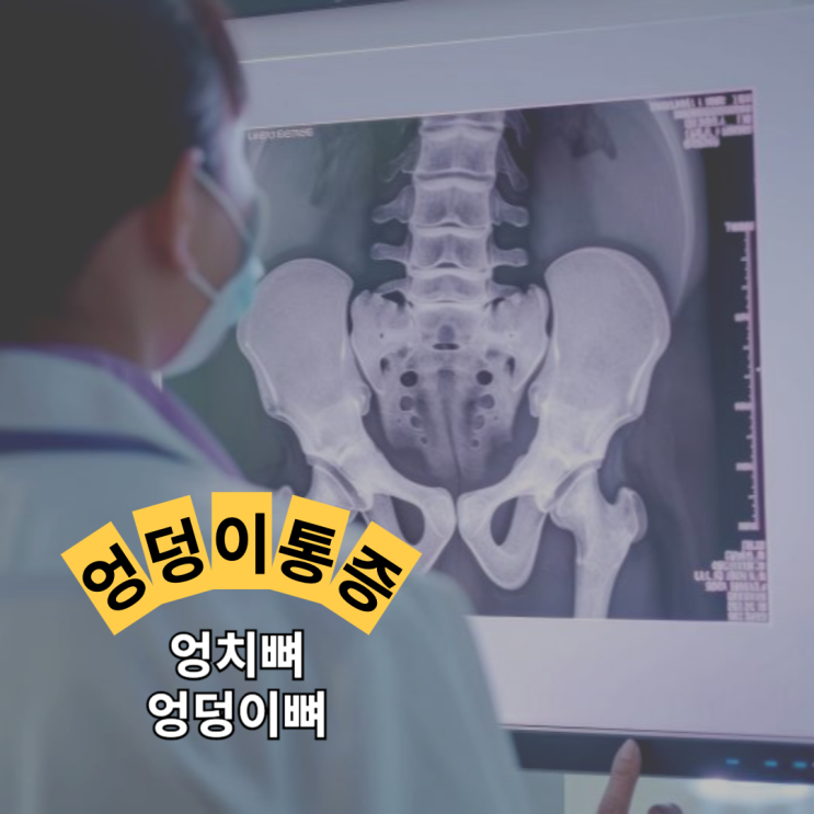 엉치(엉치뼈) 엉덩이뼈 차이 임산부 엉덩이 통증 원인 병원 치료 : 네이버 블로그