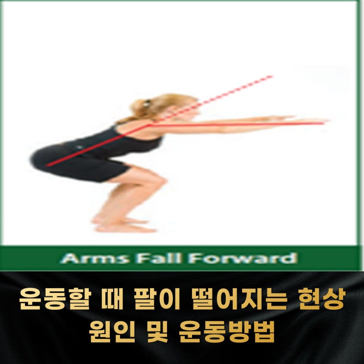 운동할 때 팔이 앞으로 떨어진다고? 오버헤드 스쿼트 보상 패턴 arm fall forward : 네이버 블로그