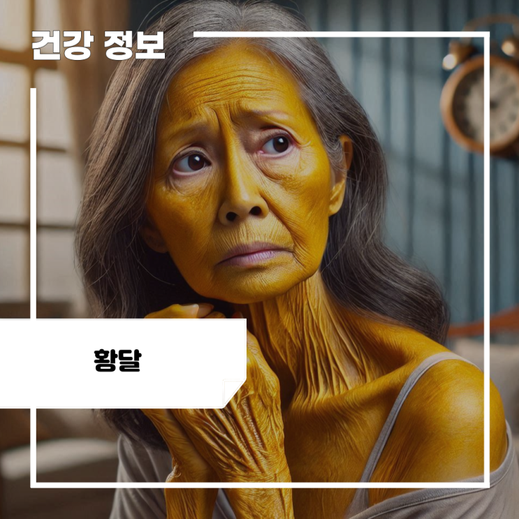 얼굴 황달 증상 및 원인, 치료 방법! 단순 증상으로 넘기면 후회할 신호! : 네이버 블로그