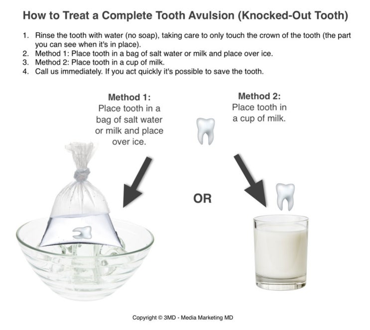 [권주형정형외과] 치아 완전 탈구 (Tooth Avulsion: 치아 완전 탈구): 응급처치와 치료 방법 : 네이버 블로그