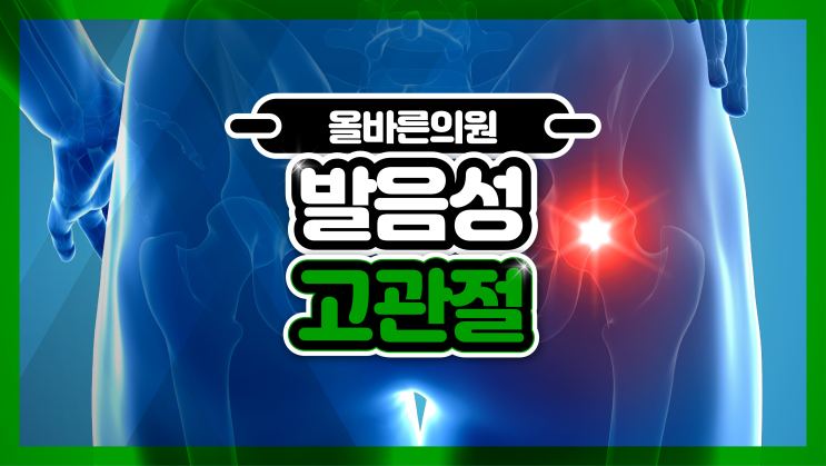 다리 움직일 때 고관절 소리? 발음성 고관절 치료 필요한 경우 : 네이버 블로그