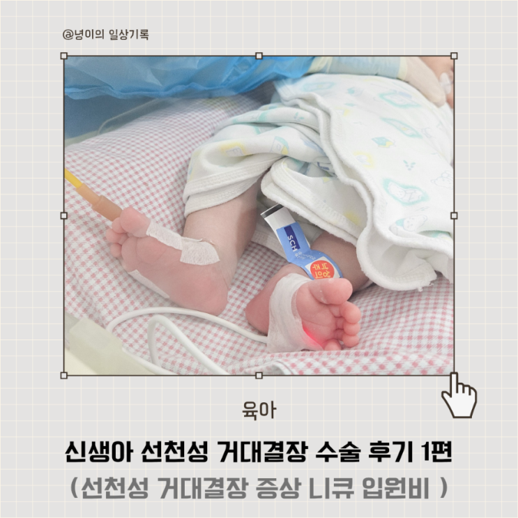 신생아 선천성 거대결장 1편 ㅣ 부천 순천향대 니큐 입원 수술 진료비 : 네이버 블로그