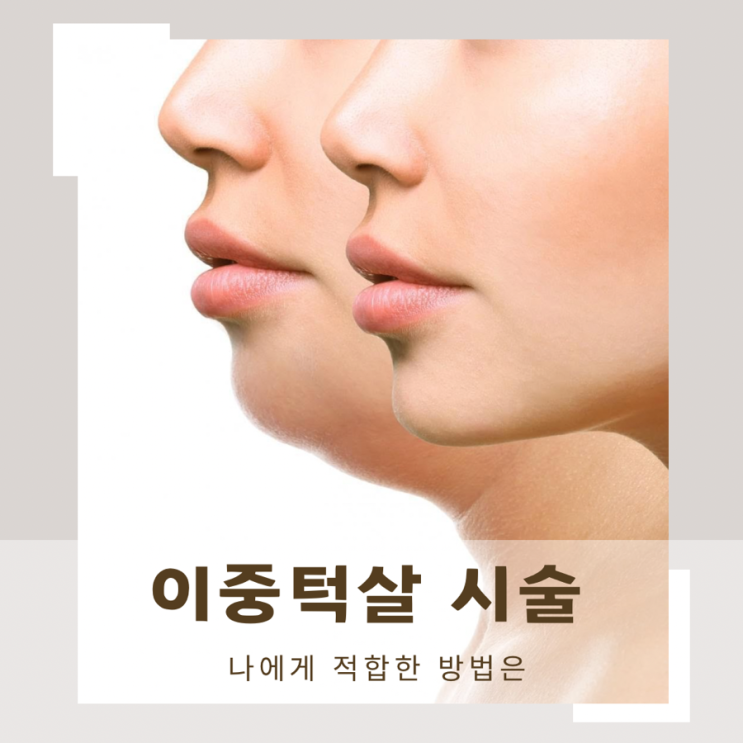 이중턱살 시술 나에게 적합한 방법은 : 네이버 블로그