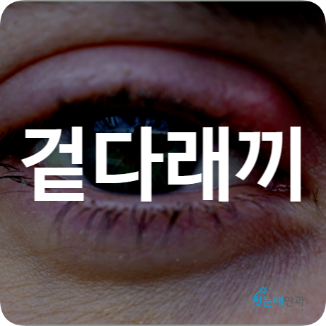 겉다래끼 초기증상 자연치유 째기 수술 약 항생제 : 네이버 블로그