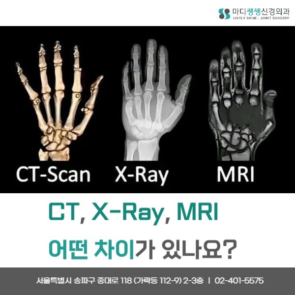 CT, MRI, X-ray 차이점 송파구 가락동 정형외과가 알려드립니다 : 네이버 블로그