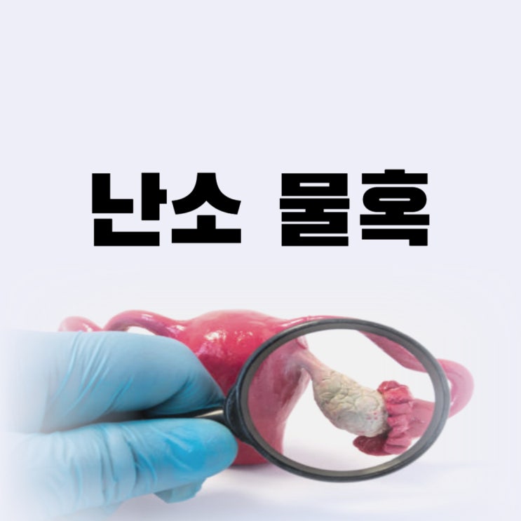 난소 물혹 6cm 4cm 증상 복강경 수술 가능할까 크기별 수술 여부와 회복 총정리 : 네이버 블로그