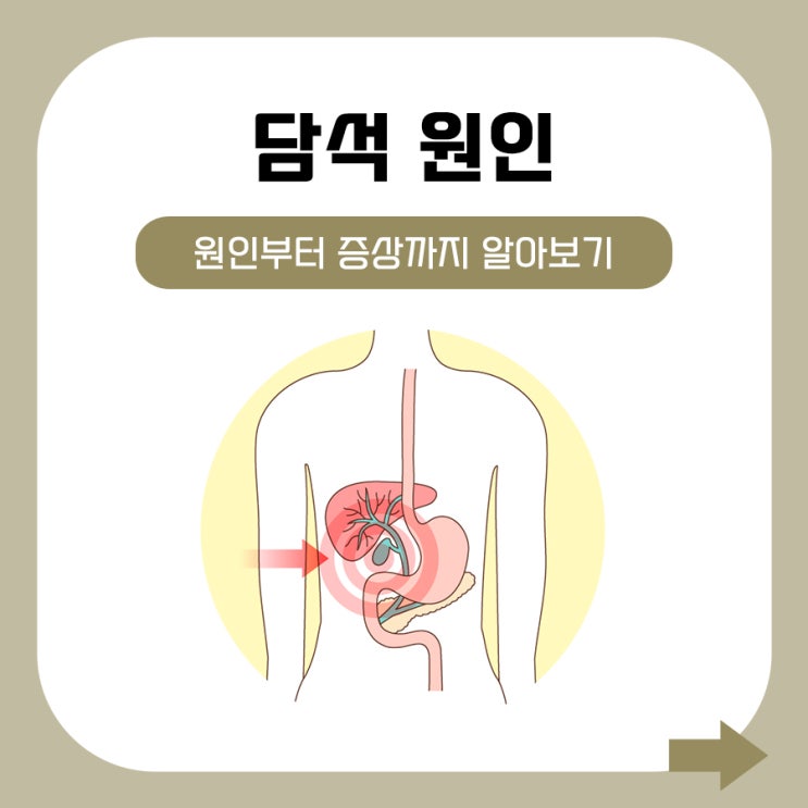 담석 원인과 증상에 대해 알아보고 대처해요 : 네이버 블로그