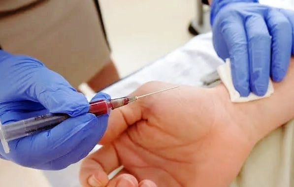 ABGA 검사 해석, 동맥혈가스분석 간단정리 : 네이버 블로그