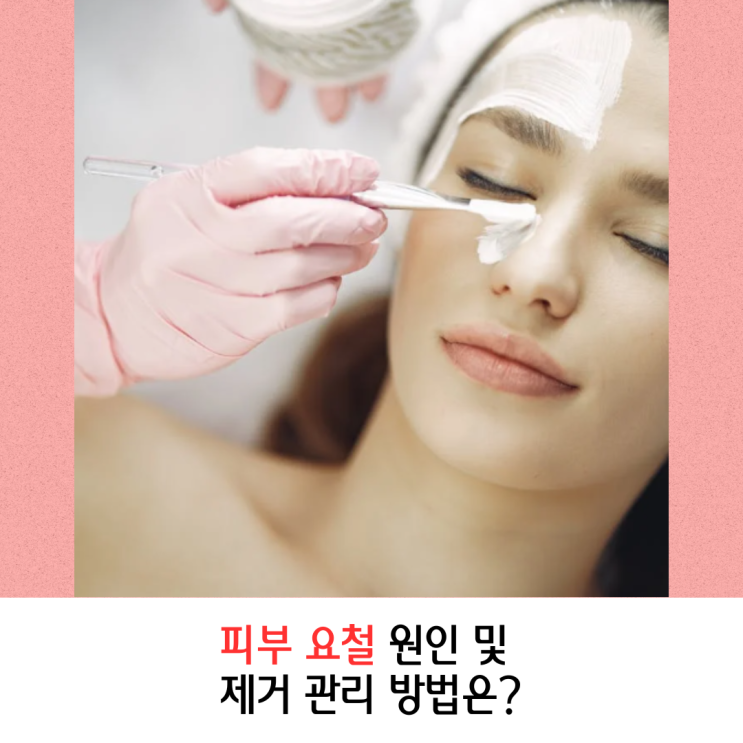 피부 요철 원인 및 제거 관리 방법은? : 네이버 블로그
