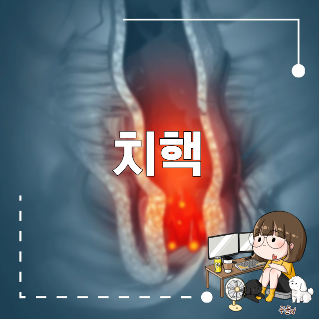 치핵 증상 외치핵 내치핵 차이점 : 네이버 블로그