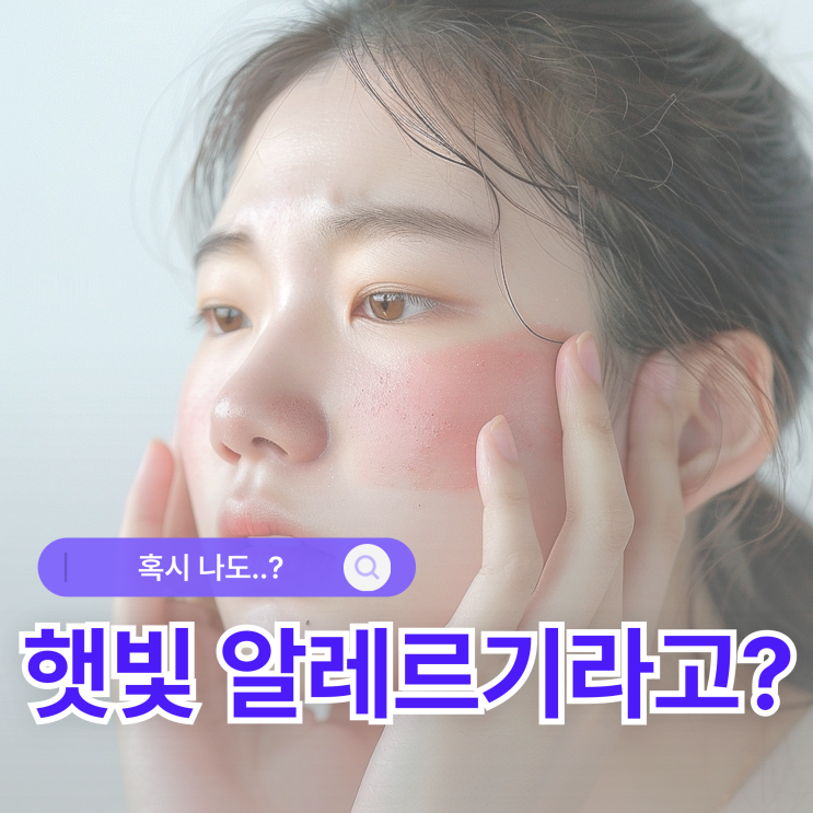 햇빛 알레르기 얼굴 따가움 가려움 증상 연고 추천 : 네이버 블로그