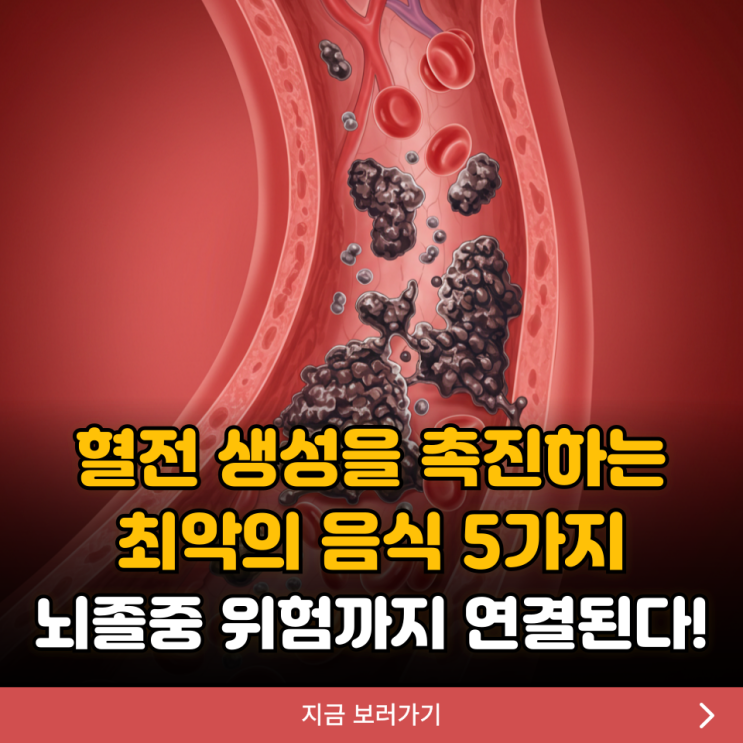 혈전 생성을 촉진하는 최악의 음식 5가지, 뇌졸중 위험까지 연결된다! : 네이버 블로그