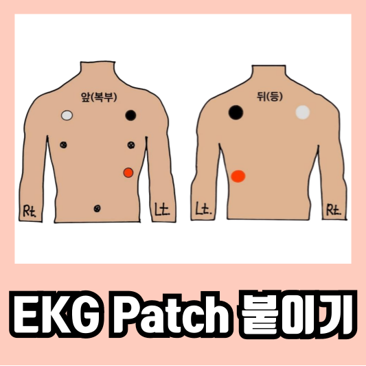 심전도 모니터 EKG Patch 붙이는 법 외우는 꿀팁 : 네이버 블로그