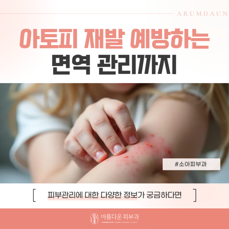대구소아피부과 아토피 재발 예방하는 면역 관리까지 : 네이버 블로그