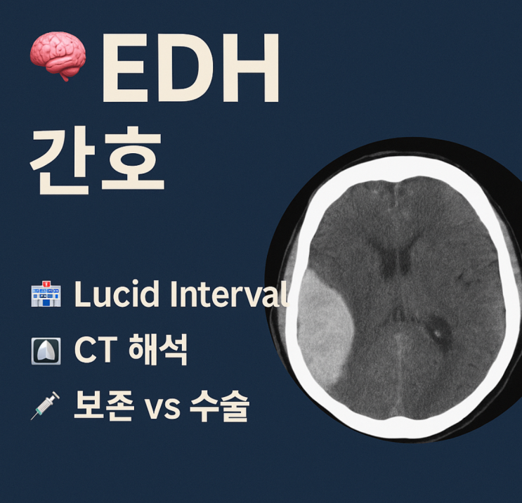 경막외출혈(EDH)란? 의학용어, 증상, CT, 간호, 치료, 수술, 후유증, burrhole, craniotomy, 개두술 ...
