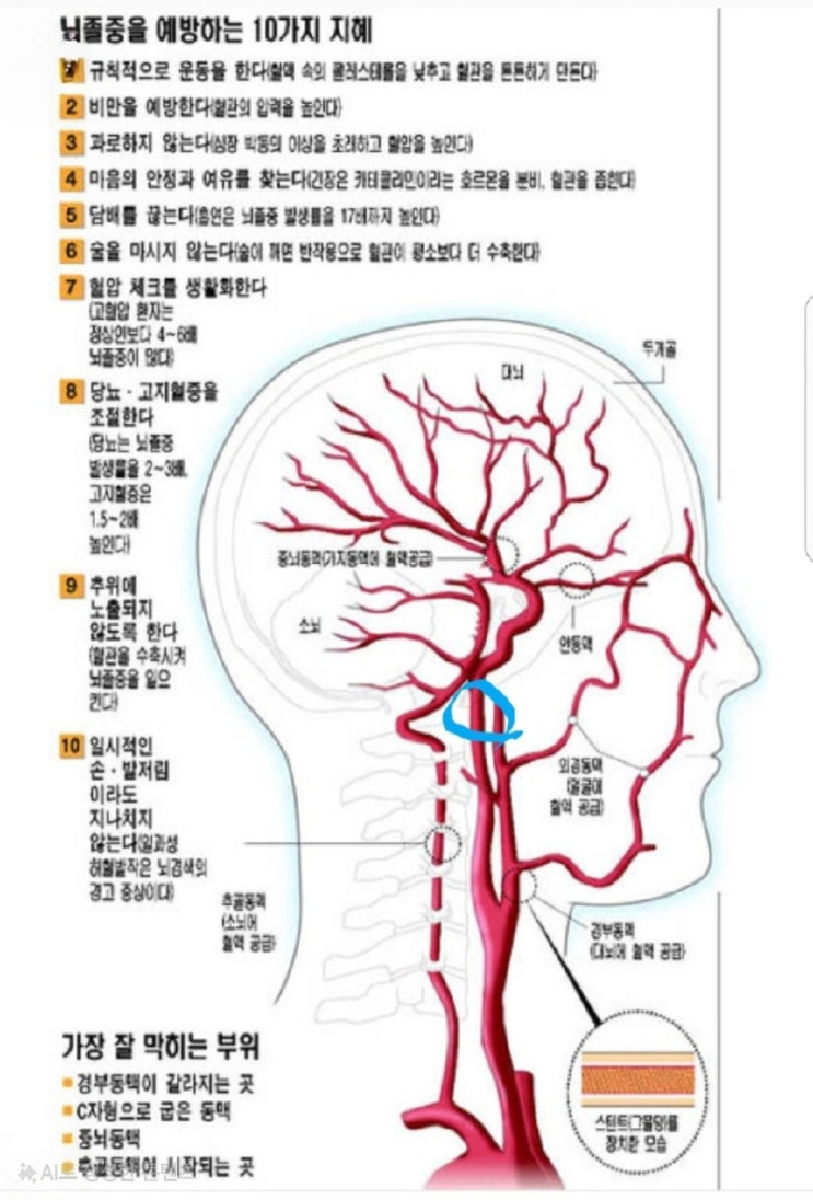 뇌 건강, 혈관 건강, 전반적인 신체 건강을 위한 다양한 홈케어 운동법과 마사지 방법 : 네이버 블로그