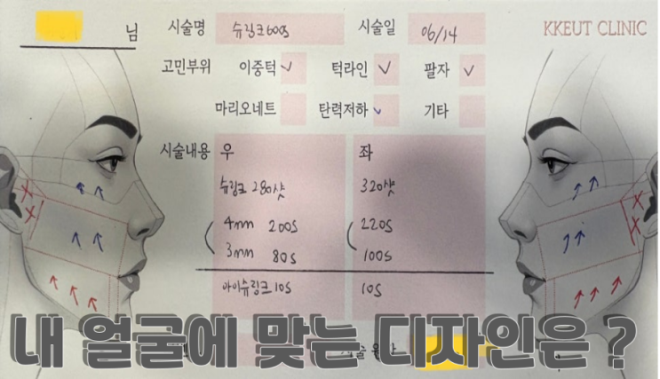 피부는 왜 ‘끗 한의원’ 인가요? : 네이버 블로그