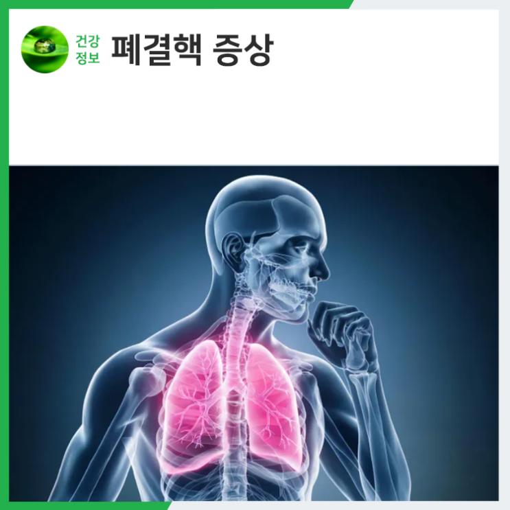 폐결핵 증상 폐결핵 전염 경로와 예방법 알아두세요 : 네이버 블로그