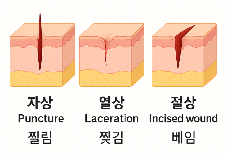 자상 열상 뜻 치료 방법 알려드립니다 : 네이버 블로그