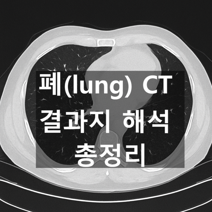 폐(lung) CT 결과지 해석 총정리 : 네이버 블로그