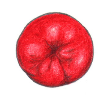 장루(stoma)란? 장루 뜻, 종류 총정리! 회장루 (ileostomy), 결장루 (colostomy), 상행결장루, 횡행 ...