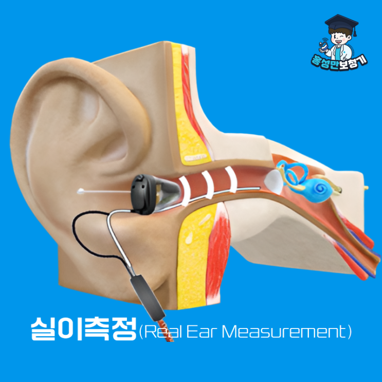 용인보청기ː실이측정(Real Ear Measurement, REM)의 중요 : 네이버 블로그