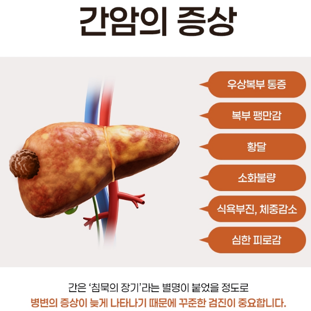 간암 증상, 원인, 종류, 진단 및 치료방법, 예방방법 : 네이버 블로그