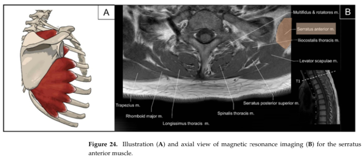 MSKUS approach to Serratus anterior : 네이버 블로그
