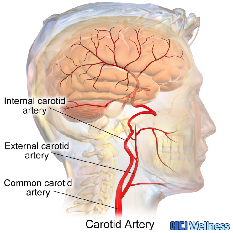 내경동맥 ICA 외경동맥 ECA Internal External Carotid Artery : 네이버 블로그