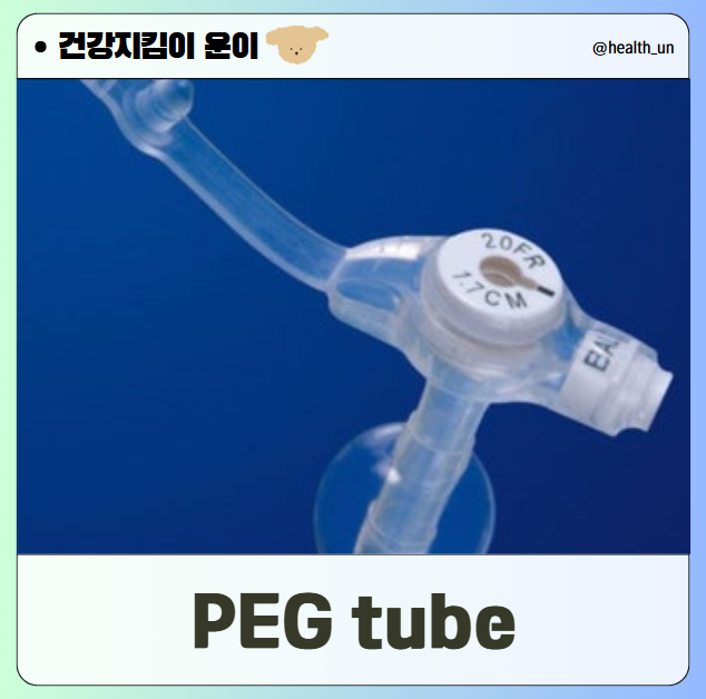 PEG tube 완벽 이해: 삽입 목적부터 관리, 부작용까지 : 네이버 블로그