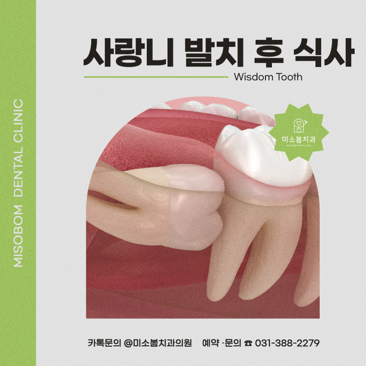 안양 비산동 치과 사랑니 발치 후 밥, 언제부터 먹어도 될까? : 네이버 블로그