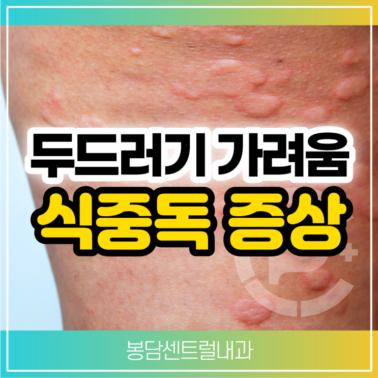 식중독 증상 두드러기 가려움 약 먹어야 할까? : 네이버 블로그