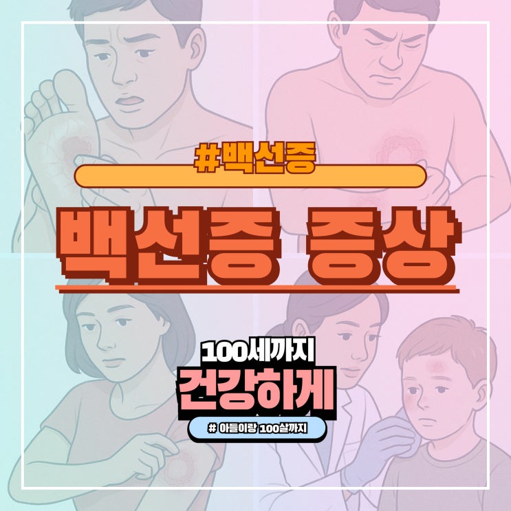 백선증 증상, 단순한 피부병이 아닙니다! : 네이버 블로그