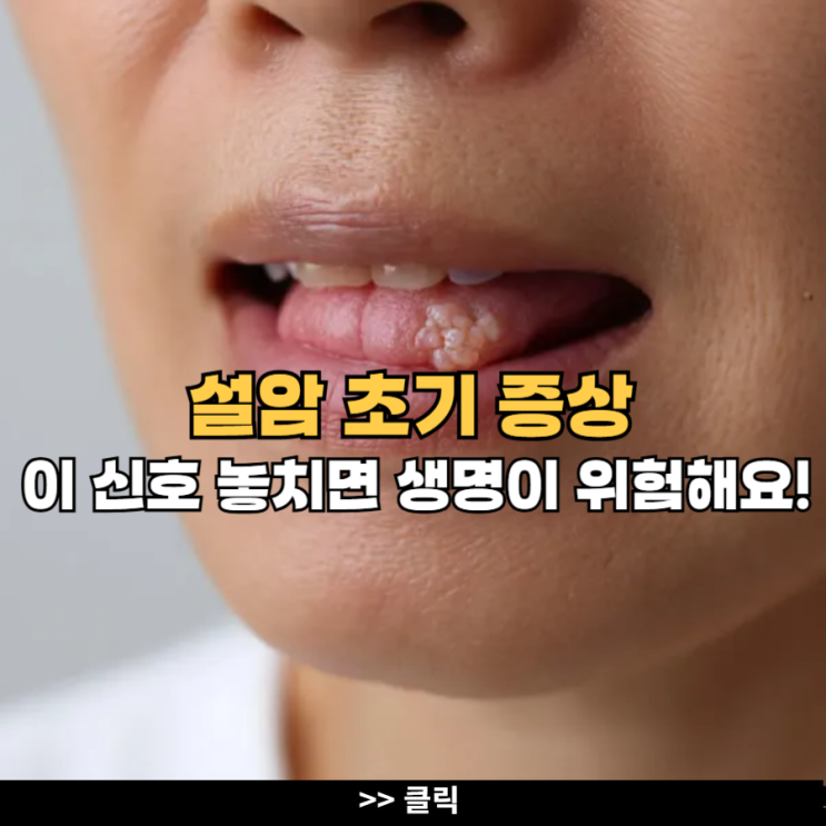 설암 초기 증상, 이 신호 놓치면 생명이 위험할 수 있어요 : 네이버 블로그
