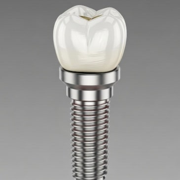 임플란트 관리 이미지