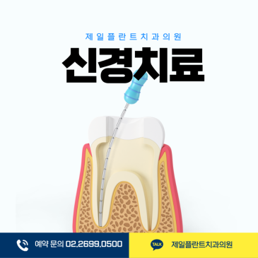신경치료 후 관리 이미지