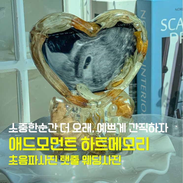 인천레진공방 초음파 탯줄 커플사진 예쁘게 보관하자! : 네이버 블로그